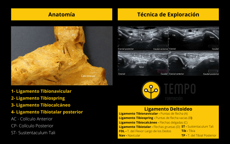 Ligamento Deltoideo.png